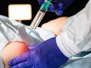 tratamento de feridas com ozônio